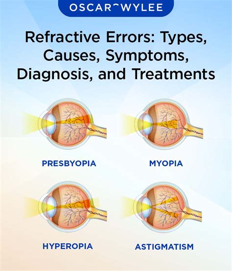 Refractive error - Wikipedia