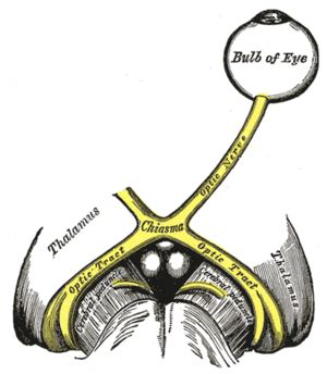 Relative afferent pupillary defect - Wikipedia