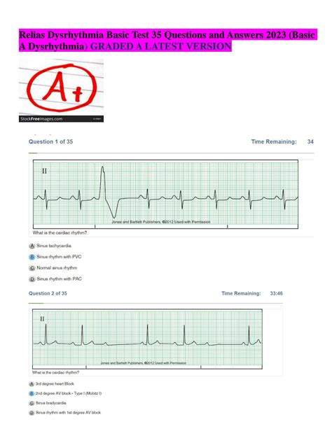 Relias Dysrhythmia Basic Test Answers normal sinus rhythm heart rhythm originating in the sinoatrial node with a rate in patients at rest of 60 to 100 beats per minute Sinus Arrhythmia Appearance is ALMOST NORMAL: ... These are the incorrect answers. . RELIAS Dysrhythmia - Advanced A Clinical Assessment User Organization. Date Completed: 1/23 ...