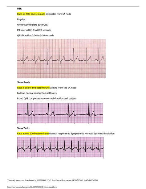 Apr 14, 2023 · Relias Dysrhythmia Basic Test Answers Solution guide ( UPDATED 2023) A+ GRADED 100% VERIFIED Normal sinus rhythm Regular Rate: 60-100 P Wave: Present, upright PR Interval: 0.12-0.20 sec QRS: &lt;0.12 sec Sinus Bradycardia Regular Rate: &lt;60 P Wave: Present, upright PR Interval: 0.12-0.20 sec QRS... .