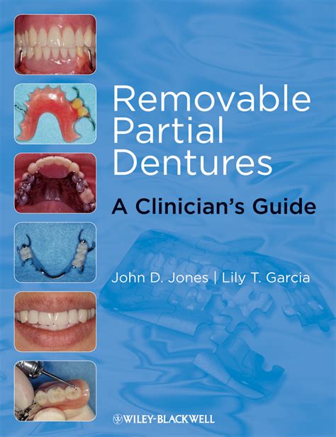 Removable partial denture prosthodontics clinical procedure manual. - The sandy puc guide to childrens portrait photography by sandy puc.