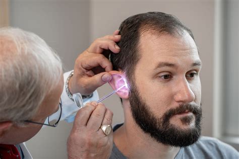 Removal of Cerumen from Ear Canal Using Lighted Curettes