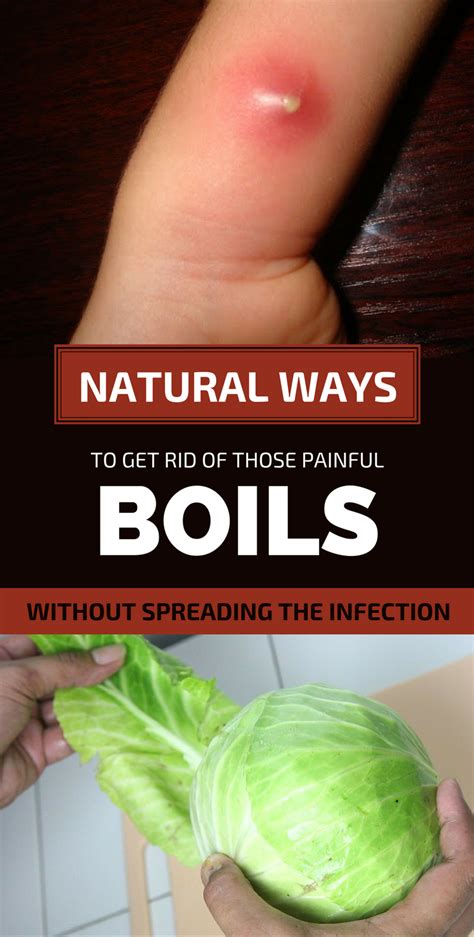 Aug 9, 2021 · lancing a boil . How To Actually lance a boil . Pop cyst . Lancing your skin boil abscesses. Infectious skin wartsThere are few things more painful than a bo... . 