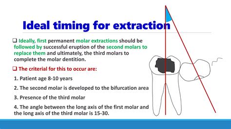 Removing second molar.  The parameters reviewed include the timing of extractions and ...