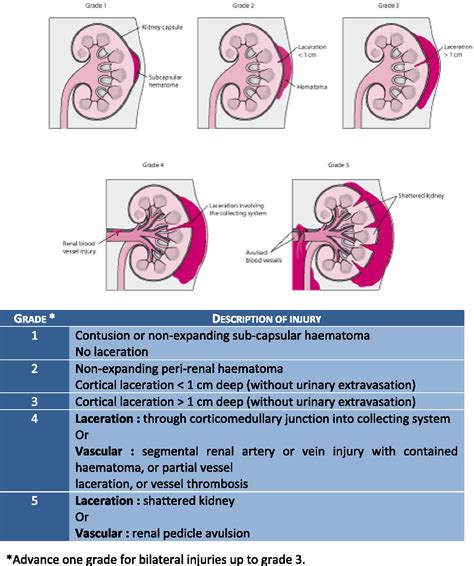 Renal Hematoma (Hematoma of Kidney): Symptoms, Diagnosis …