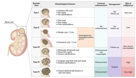 Renal cysts in pediatric patients. A classification and overview