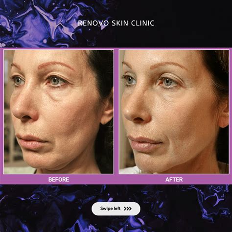 Renovo Skin Clinic - Accueil - Facebook