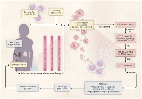 Resources for patients with post-transplant lymphoproliferative ...