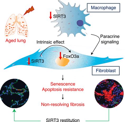 Restoration of SIRT3 gene expression by airway delivery resolves age …