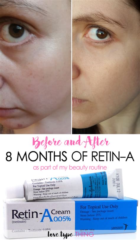 Retin-a before and after. Things To Know About Retin-a before and after. 