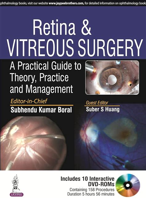 Retina and vitreous surgery a practical guide to theory practice and management. - Repair manual haier gdz22 1 dryer.