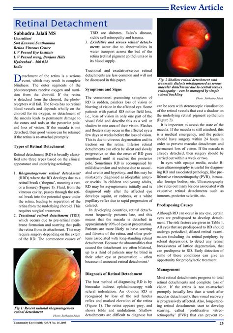 Retinal Detachment PDF