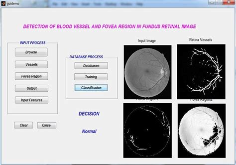 Retinal vessel segmentation matlab code.  Mar 25, 2019 · The algorithm...