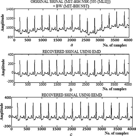 Review of noise removal techniques in ECG signals