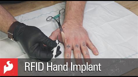 Rfid implant. The primary uses of an RFID or NFC implant are to allow humans access to something (a home, computer, vehicle, electronic safe, business, etc.) or to share data with someone. An NFC implant can store data to be shared such as contact details, website information, bitcoin wallet addresses, and more! Biohacking is the next phase of human evolution. 