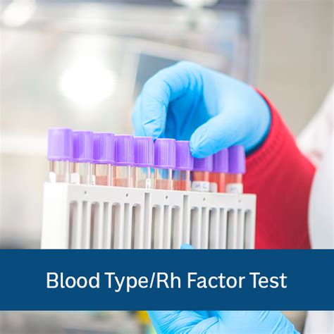 Rh factor testing - Wikipedia