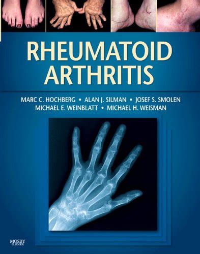 Rheumatoid arthritis manual free ebooks download. - Opengl es 2 0 hello world example.