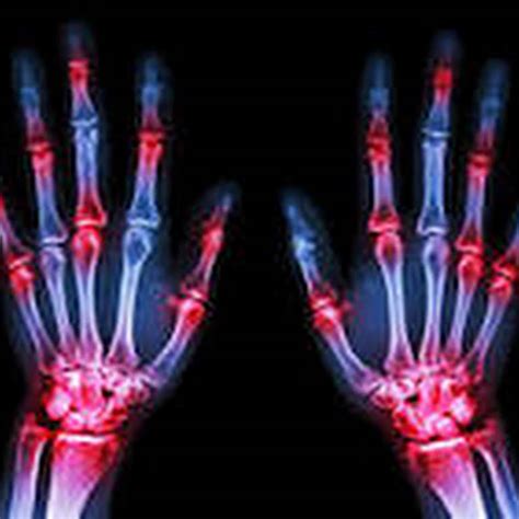 Rheumatologists - Limassol