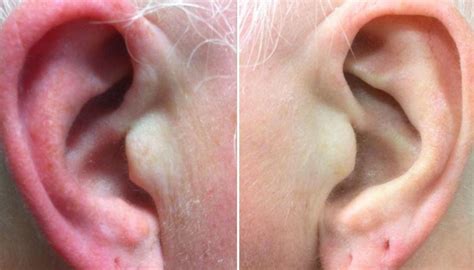 Right ear hot. Things To Know About Right ear hot. 