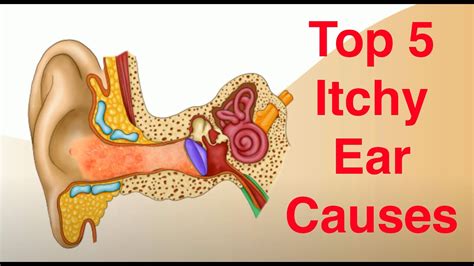 Right ear itch means. Outlook. Summary. Infections and allergies are the main causes of itchy ears and throat. Home remedies and medical treatments may help alleviate symptoms. … 