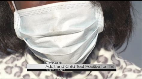 Riverside County child tests positive for tuberculosis