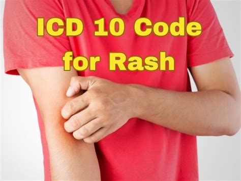 Road rash icd 10. R21 is a billable/specific ICD-10-CM code that can be used to indicate a diagnosis for reimbursement purposes. The 2024 edition of ICD-10-CM R21 became effective on … 