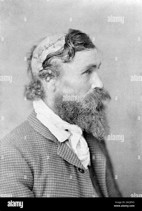 Robert McGee, scalping victim. This photograph, taken circa 1890, …