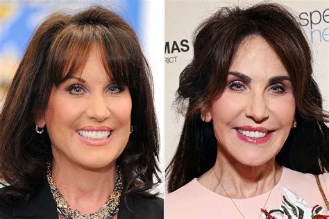 Who Is Robin McGraw; Robin McGraw Plastic Surgery Procedures. Eyebrow Transplant; Neck Lift And Facelift; Botox And Fillers; Robin McGraw Before …