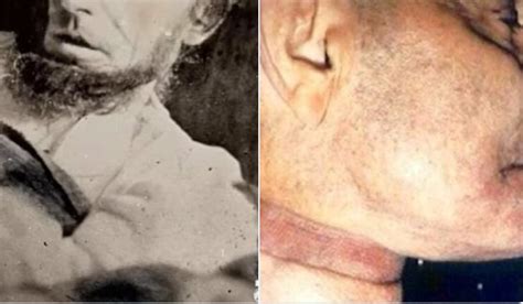 Robin williams autopsy photo. A newly uncovered document has revealed that Robin Williams worked to restrict usage of any images of himself for 25 years after his death.. The Robin Williams Trust - a deed which has been ... 