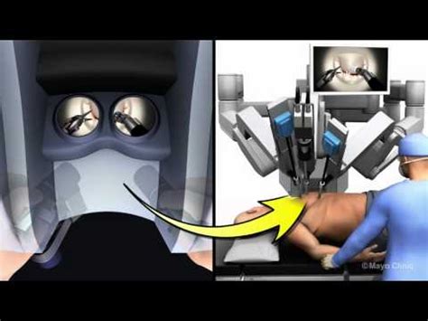 Robotic Assisted Mitral Valve Repair