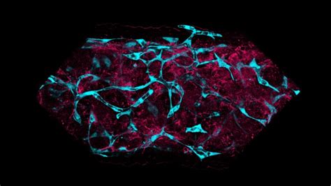 Roche Organoids: turning science fiction to reality