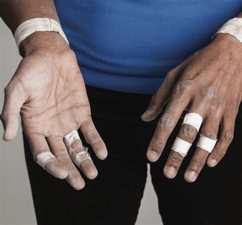 Rock Climbing Finger Tenosynovitis - The Climbing Doctor