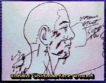 Ron goldman autopsy. 1 Autopsy Report 94-05135 I performed an Autopsy on the body of Goldman, Ronald at the DEPARTMENT OF CORONER Los Angeles, California on June 14, 1994 @1030 HOURS From the anatomic findings and pertinent history, I ascribe the death to: MULTIPLE SHARP FORCE injuries Due To Or As a Consequence of _____ Anatomical Summary: … 