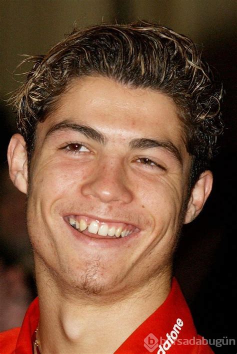 Ronaldo estetiksiz