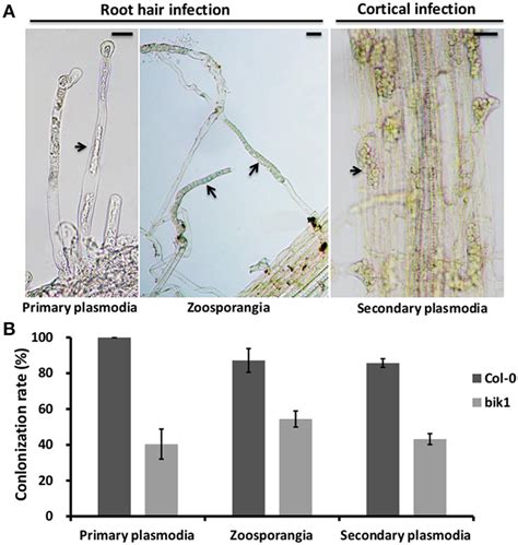 Root hair and cortical infection stages in the roots of Arabidopsis... Download Scientific Diagram