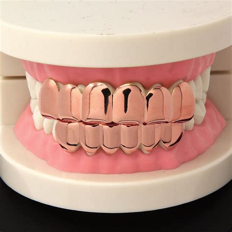 Custom gold grillz are available in 10K, 14K, 18K, and 22K gold purity and you can choose from different color variants such as yellow gold, white gold, rose gold, and black gold. Our highly experienced and skilled teeth grillz manufacturers can craft custom gold grillz based on your instructions or details. Order custom gold grillz and we will .... Rose gold grillz