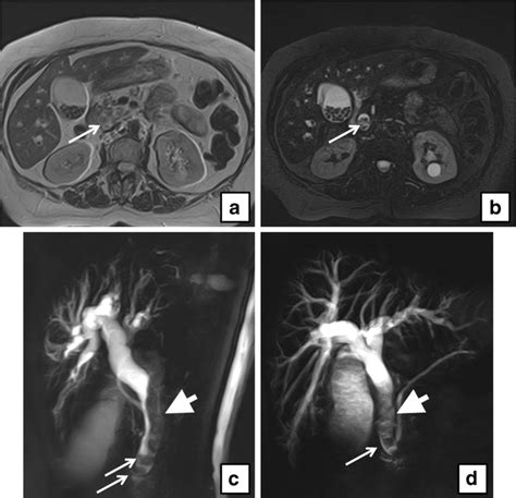 Routine MRCP in the management of patients with