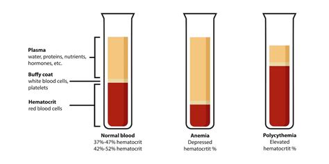 Running effect on sperm.  Along with an increase in hematocrit, a major ...