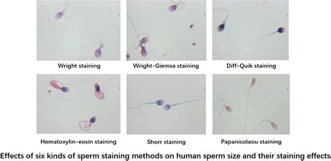 Running effect on sperm.  The effect held true even when other factors...