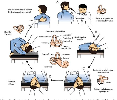 Running-Induced Vertigo in an Adolescent: A Treatable …