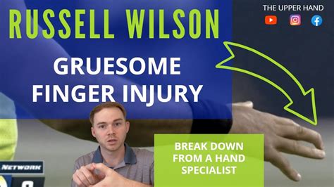 Russell Wilson Finger Injury!! IS HIS SEASON OVER??? - YouTube