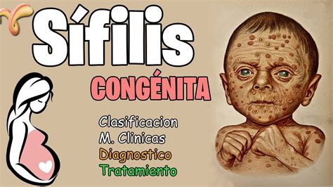 SÍFILIS CONGÉNITA. - bvsalud.org