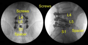 S1 - Program Perkuliahan Karyawan - Biaya Pendidikan & Cara … - balustradellc
