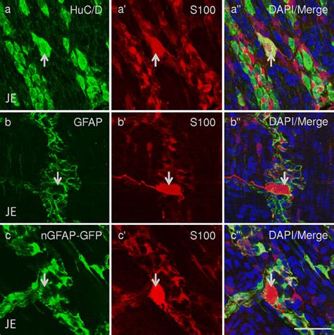 S100 - MOXI - Infinite Motion x Innovation - muktibox.com