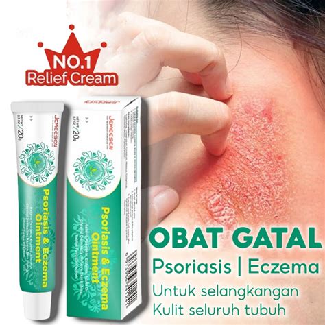 Salep Gatal Paling Ampuh Obat Gatal Obat Eksim Psoriasis Salep Gatal ... - balustradellc