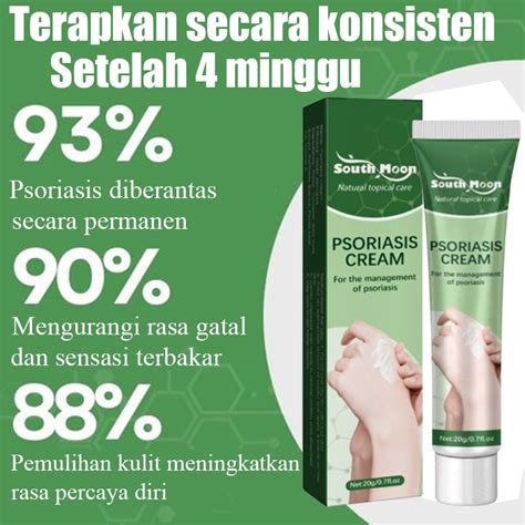 Salep khusus psoriasis ointment - import - kurap pada kulit kepala ... - balustradellc