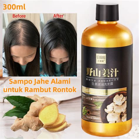 Sampo Rambut Ketombe Dan Rontok - raincitystudios.com