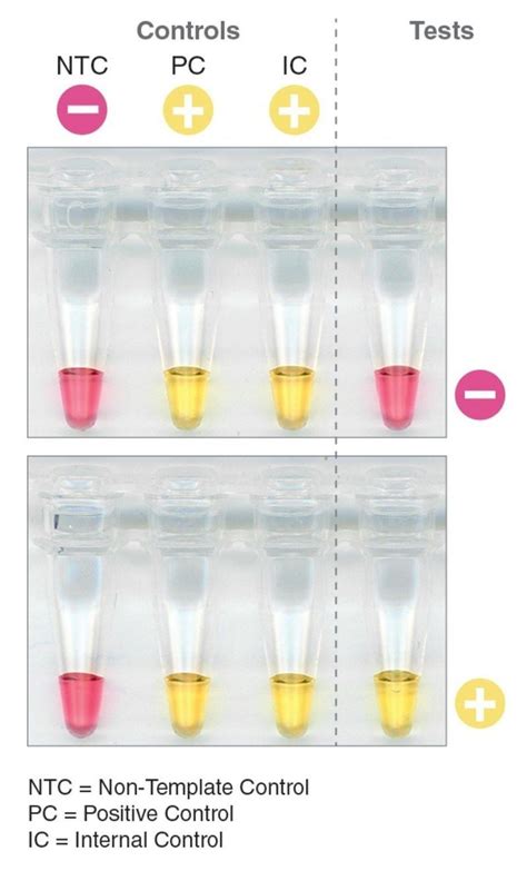 SARS-CoV-2 Rapid Colorimetric LAMP Assay Kit NEB