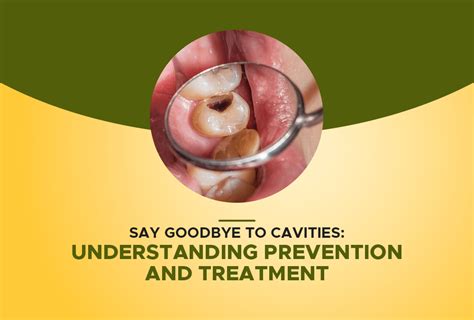Say Goodbye to Cavities: Proven Prevention ... - Smart … - balustradellc