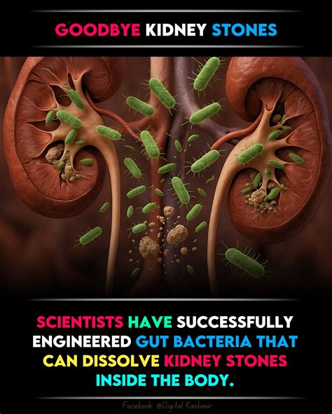 SCIENTISTS DISCOVER BACTERIA LIVING INSIDE KIDNEY STONES … - balustradellc